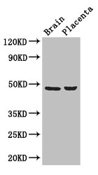 CSB-PA850816LA01HU