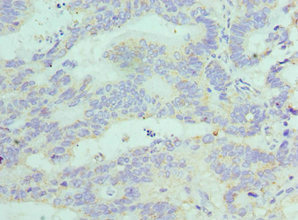 CSB-PA008615ESR1HU