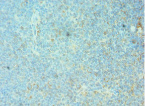 CSB-PA008792DSR1HU