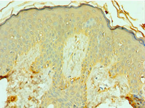 CSB-PA008792DSR1HU