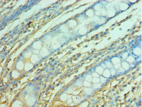 CSB-PA008792DSR1HU