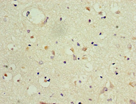 CSB-PA615671DSR2HU
