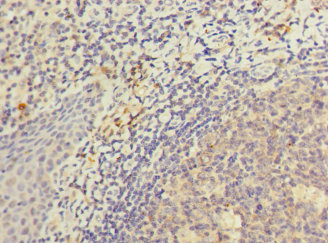 CSB-PA850818ESR1HU