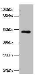 CSB-PA850818ESR1HU