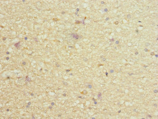 CSB-PA852881ESR1HU