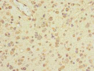 CSB-PA852881ESR1HU