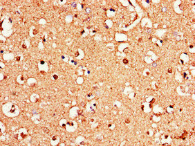CSB-PA009931LA01HU