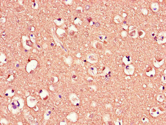 CSB-PA853101LA01HU