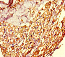 CSB-PA889082LA01HU