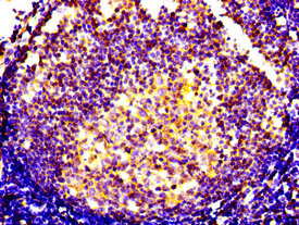 CSB-PA006255LA01HU