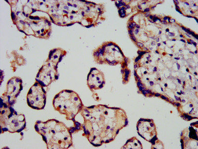 CSB-PA018746LA01HU