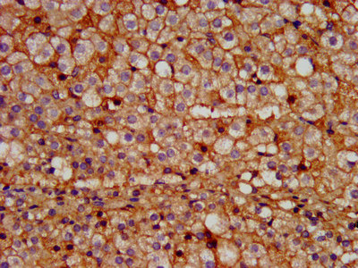 CSB-PA018746LA01HU
