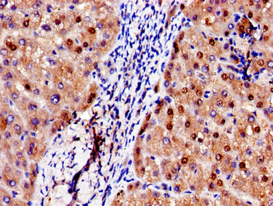 CSB-PA001311LA01HU