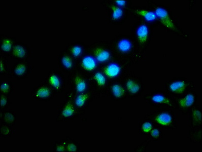CSB-PA008615ESR1HU