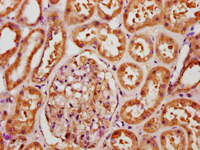 CSB-PA008615ESR1HU