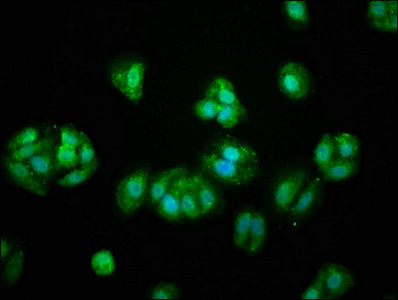 CSB-PA018754LA01HU