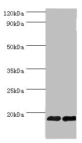 CSB-PA008615ESR1HU