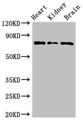 CSB-PA614260LA01HU