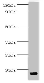 CSB-PA868302ESR1HU