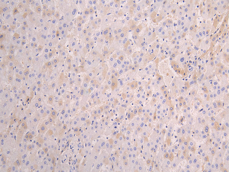 CSB-RA001898MA1HU