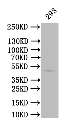 CSB-RA004458MA1HU
