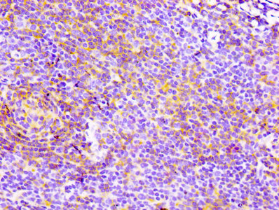 CSB-RA004935A0HU IHC