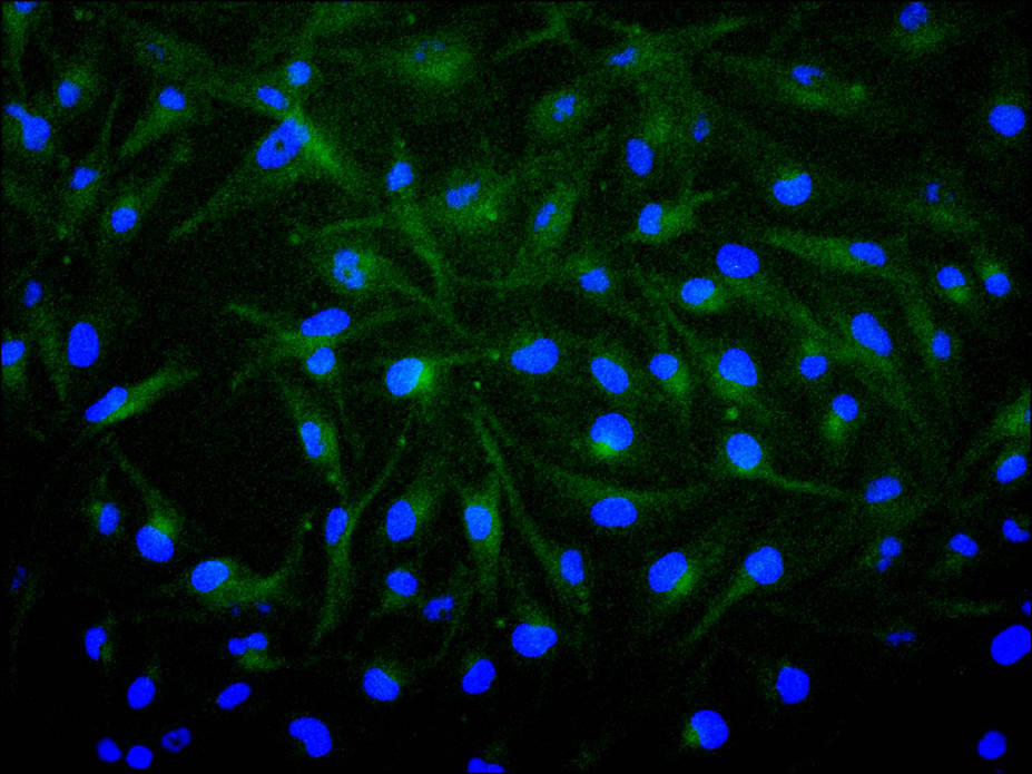 CSB-RA008615MA1HU