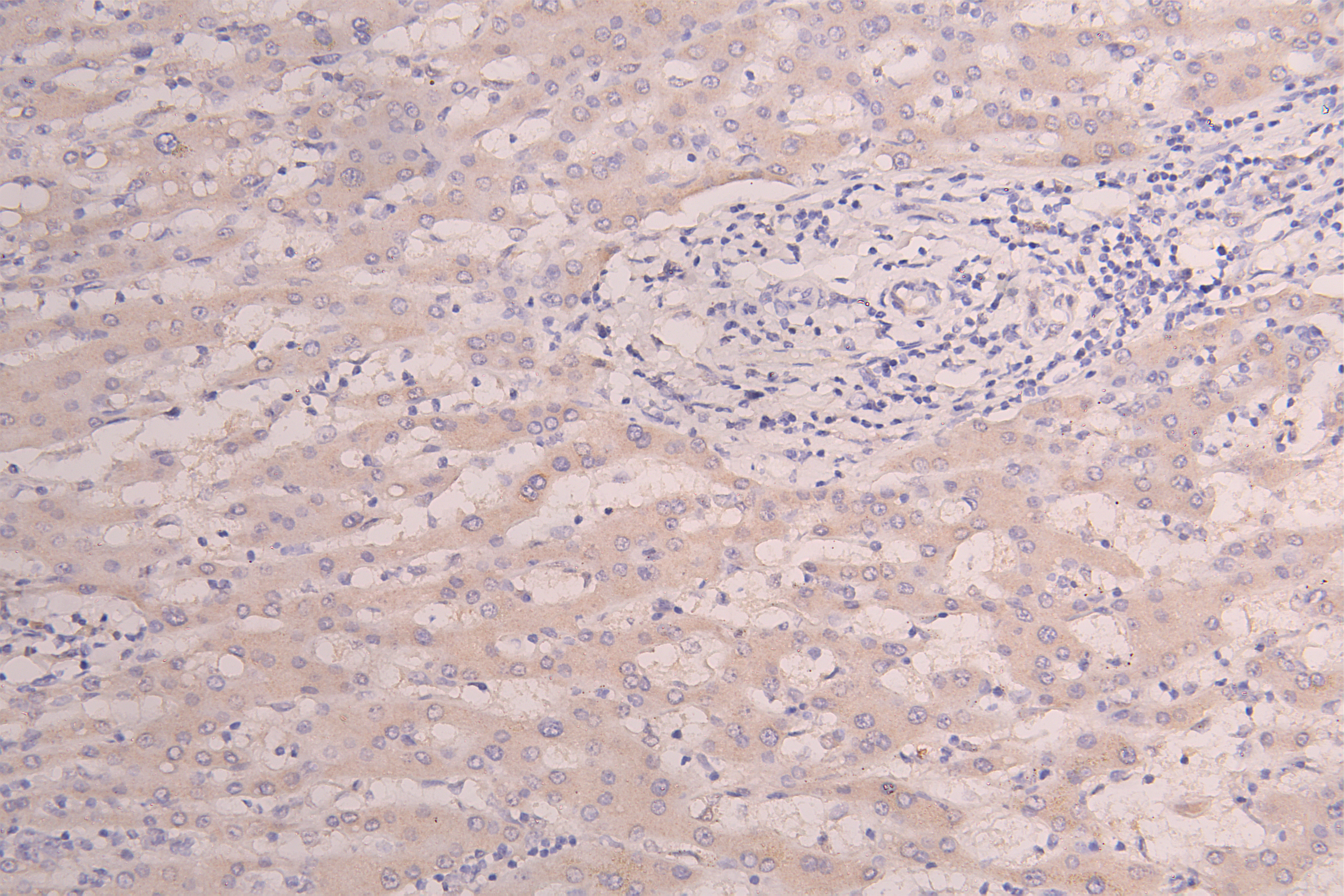 CSB-RA010327MA1HU