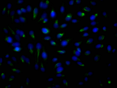 CSB-RA152329A0HU