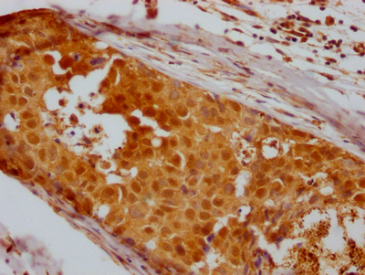 CSB-RA593846A0HU