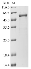 CSB-EP009956HU