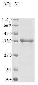 CSB-EP013263HU